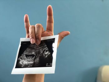 Cropped hand holding sonography report