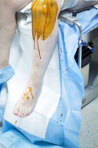 Low section of wounded patient leg sitting in hospital