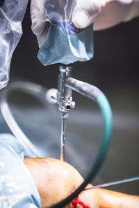 Cropped hand of surgeon operating patient at hospital