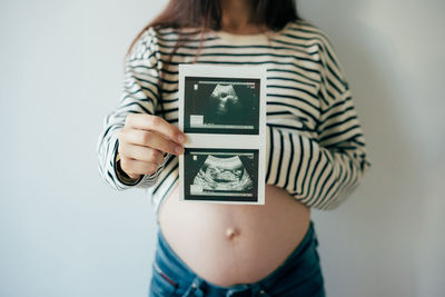 A pregnant woman is holding an ultrasound scan of an expected baby.