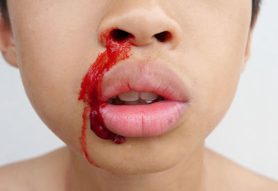 Midsection of boy with bleeding nose against white background