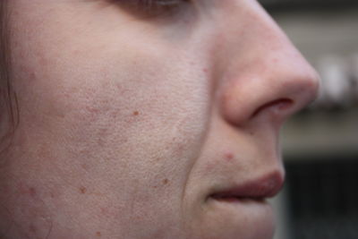 Close-up of young woman skin