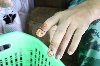 Cropped hand of injured man