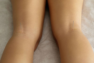 High angle view of woman with acupuncture needles in leg