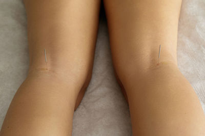 High angle view of woman with acupuncture needles in leg