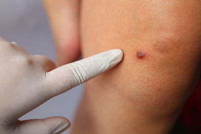 Cropped hands of doctor examining patient knee