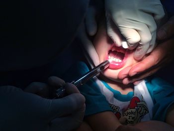 Cropped hands of dentists operating boy in clinic