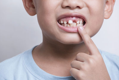 Boy's face looking at the tooth and showing teeth behind on white background