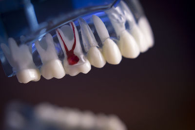 Close-up of dentures against black background
