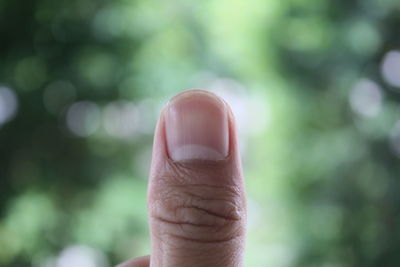 Close-up of thumb against trees