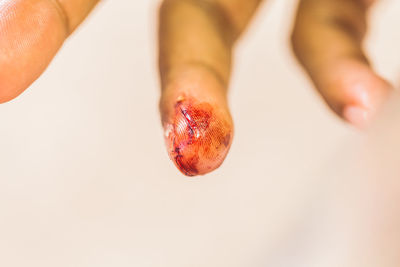 Close-up of person with wound on finger over white background