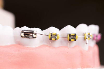 Close-up of dentures against black background