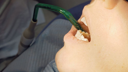 Close-up of woman with dental equipment
