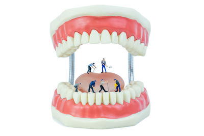 Miniature people and dental model object,dental care concept