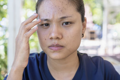 Young asian woman worry about her face when she has problems with skin on her face in a nature