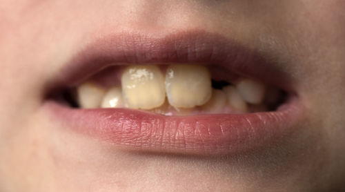 Macro shot of human teeth