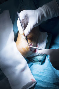 Cropped hands of surgeons operating patient leg in hospital