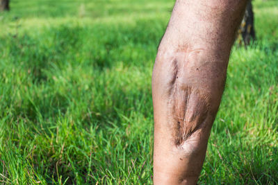 Man with knee injury