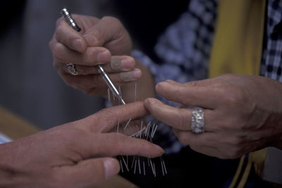 Cropped image of person getting acupuncture treatment