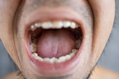 Close-up of man making face