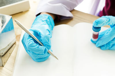 High angle view of person writing blood reports