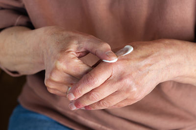 Elder woman applying cream or ointment to her hands with atopic dermatitis, eczema, allergy reaction