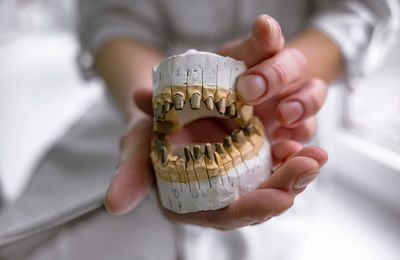 Tooth casts for prosthetics