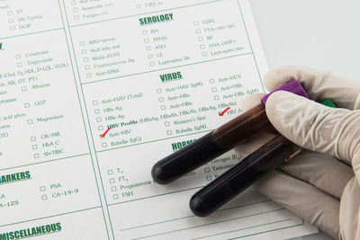 Cropped hand holding blood test tube on report