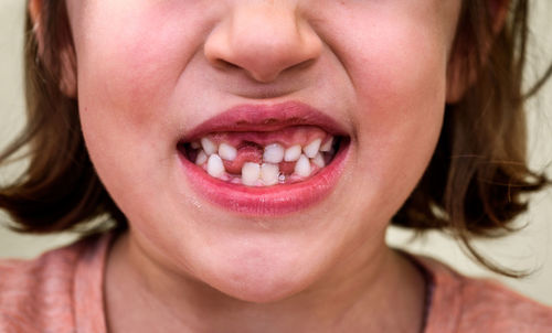 Close-up midsection of cute showing tooth