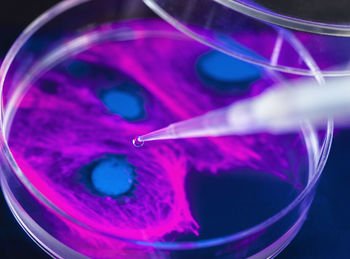 Pipetting of sample into petri dish containing cell micrograph