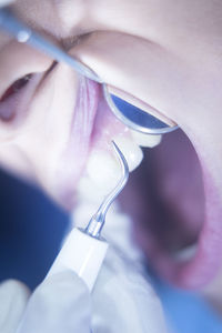 Cropped image of dentist examining patient teeth in medical clinic