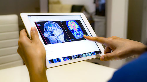 Cropped hands of doctor holding digital tablet with x-ray on table