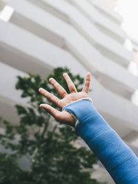 Close-up of a casted injured arm