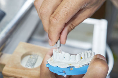 Cropped image of dentist molding dentures