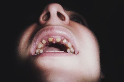 Close-up of woman with rotten teeth against black background