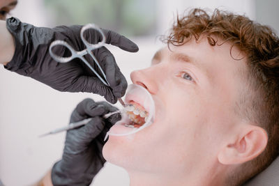 The orthodontist fixes the arch with ligatures to the braces, happy patient with curly hair