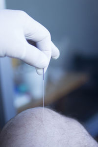 Close-up of hand holding acupuncture needle 