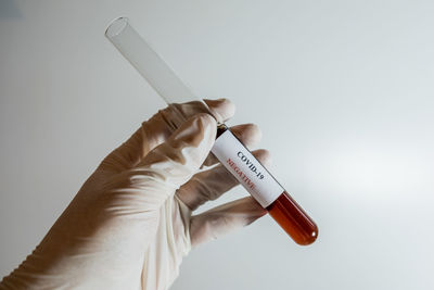 Close-up of hand holding bottle against white background