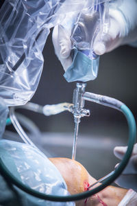 Cropped hand of surgeon operating patient at hospital