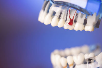 Close-up of dentures against blue background