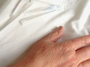 Close-up of woman hand with acupuncture needle on bed