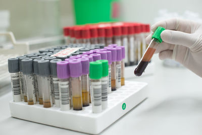 Cropped hand of scientist testing chemical in laboratory