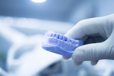 Close-up of hand holding dental mold