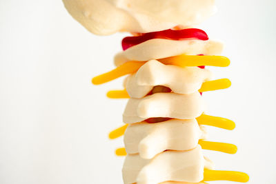 Close-up of dentures against white background