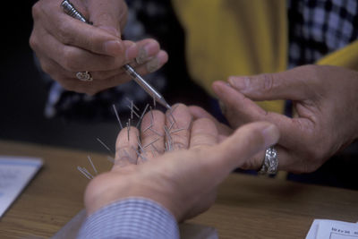 Cropped image of person getting acupuncture treatment