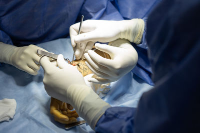 Doctors operating hand and wrist in hospital