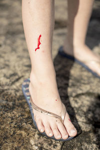 Low section of girl with wounded leg standing on rock