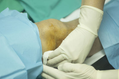 Close-up of surgeon cleaning patient wounded knee in hospital