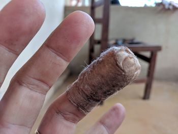 Close-up of human hand with bandage wrapped in ring finger at home