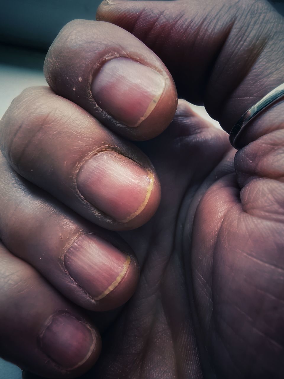 CLOSE-UP OF PERSON HOLDING HAND WITH TATTOO